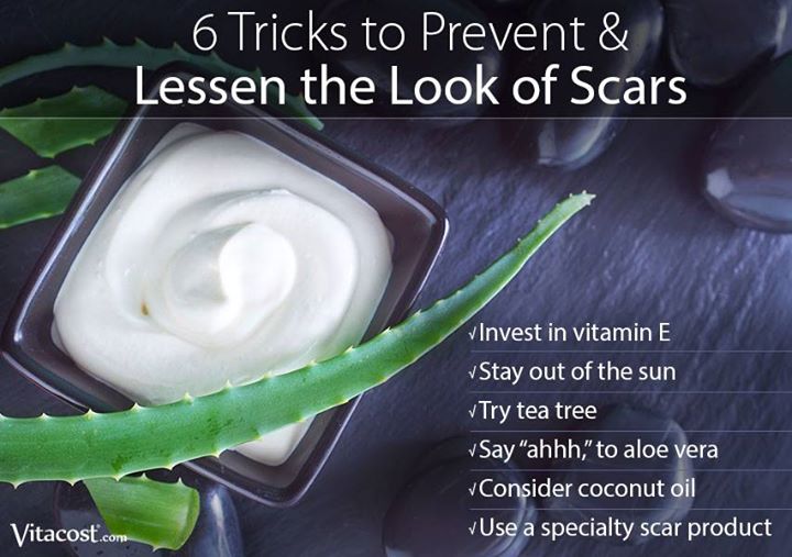 6 Tricks to Prevent & Lessen the Look of Scars