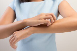 What You Need to Know About Dry, Itchy Skin