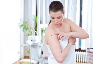 How to Recognize Potentially Dangerous Spots on Skin