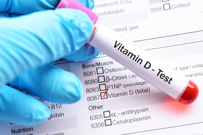 What Doctors Want You to Know About Vitamin-Level Testing