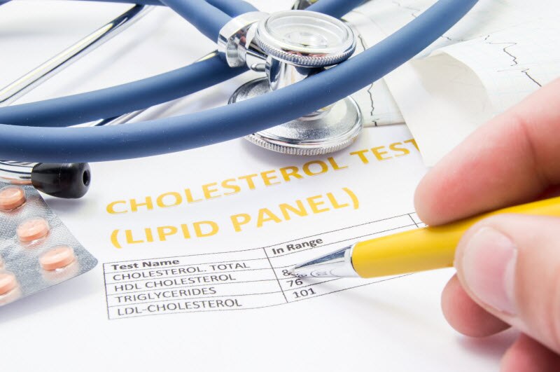 Cholesterol Levels Represented by Chart Showing Test Results and Stethoscope | Vitacost.com/blog