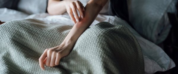 Torso View of Woman in Bed Scratching Red, Inflamed Arm in Needs of Natural Remedies for Eczema