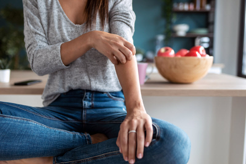 Home Remedies for Bug Bites and Stings Torso View of Woman Scratching Arm to Represent Concept of Home Remedies for Bug Bites and Stings