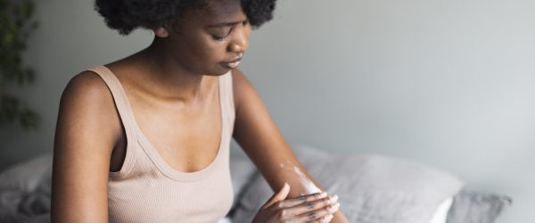 Is Rosemary a Natural Way to Heal Scars? What the Science Says Woman Using Rosemary as a Natural Way to Heal Scars